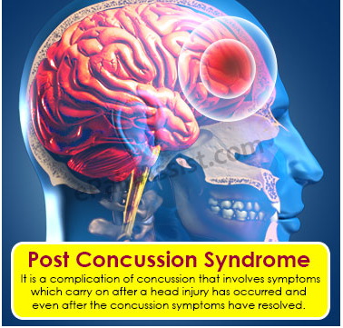 post concussion image